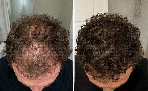 Rendu de camouflage capillaire Velmora